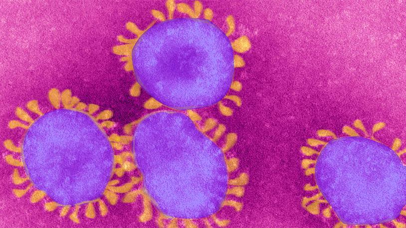 Health officials said Wednesday, Feb. 5, 2020, that the first case of coronavirus has been confirmed in the state. Twelve cases of the deadly virus have been reported nationwide.