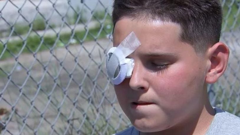 Cody Hilts says he feels lucky he didn’t lose his eye after he was shot with a paintball gun Monday in Brockton, Massachusetts.