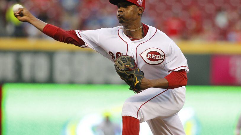 Reds pitcher Raisel Iglesias got some good news when results of an MRI showed just a contusion and no structural damage to his right elbow Wednesday. File