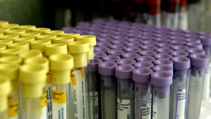 Butler County is on pace to end 2018 with 800 new cases of Hepatitis C and 23 new cases of HIV, according to the Butler County Health Department.