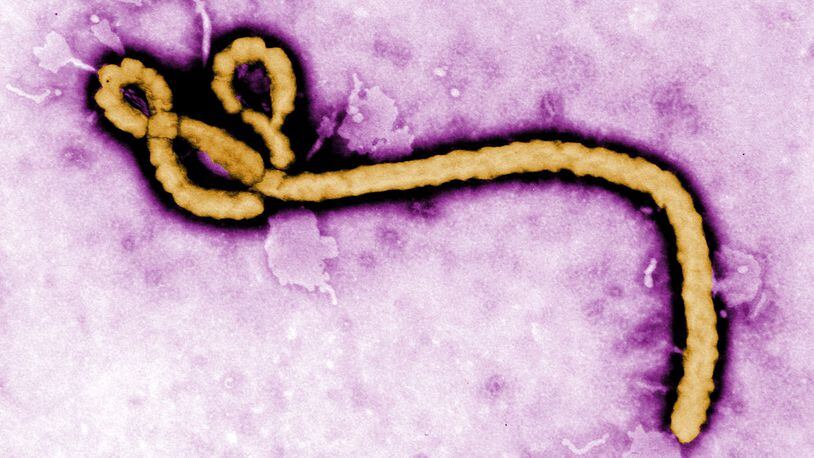 UNDATED:  In this handout from the Center for Disease Control (CDC), a colorized transmission electron micrograph (TEM) of a Ebola virus virion is seen.