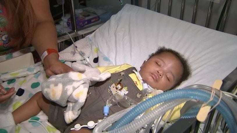 At Children's Hospital of Atlanta, a baby boy is breathing a lot easier, thanks to a life-saving procedure involving a 3D printing machine.
