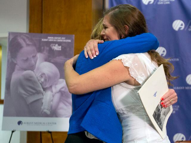 Burned as baby, woman finally meets nurse who cared for her