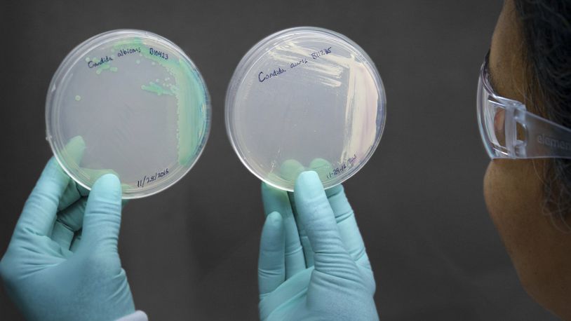 An undated photo provided by the Centers for Disease Control and Prevention shows a cultured Candida auris, right, and cultured Candida alibicans. The World Health Organization has released a ranking of fungi that threaten human health in its most ambitious effort to draw attention to a constellation of pathogens that are largely overlooked, even as they have become increasingly widespread, resistant to treatment and deadly. (Centers for Disease Control and Prevention via The New York Times) — NO SALES; FOR EDITORIAL USE ONLY —