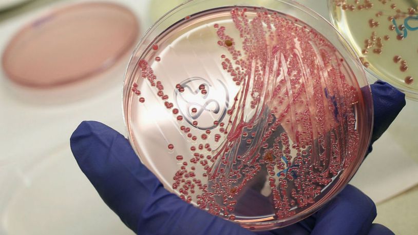 E. coli bacteria. File photo. (Photo: Sean Gallup/Getty Images)