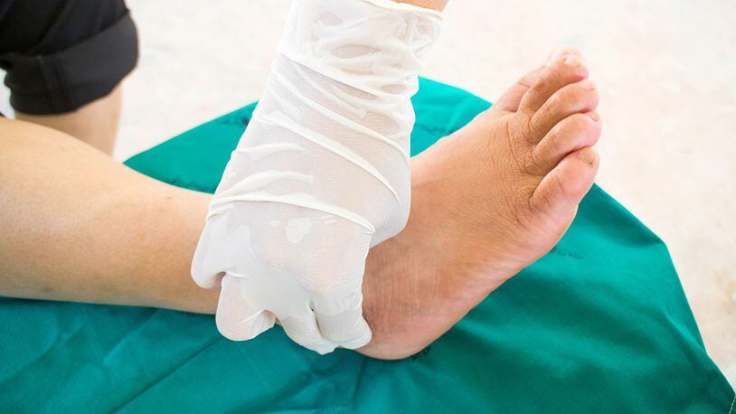 Foot care is a big challenge for diabetes patients, and it can become even more complicated if they're suffering from Charcot foot disease.