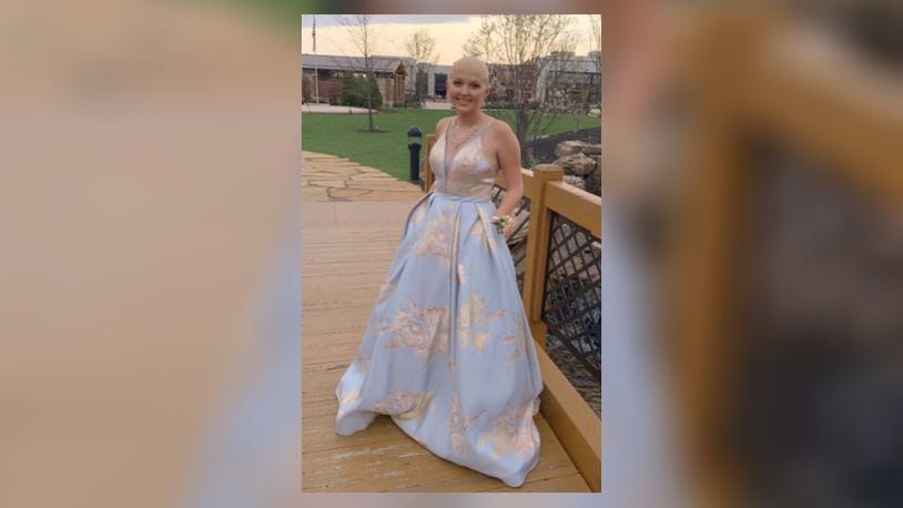 Mattie Cole, 16, a sophomore at Madison High School, is battling a rare form of bone cancer. Despite the chemotherapy treatments, Mattie went to her high school Prom Saturday night. She wore a wig for part of the evening, then took it off when it got hot and itchy, her mother said. SUBMITTED PHOTOS