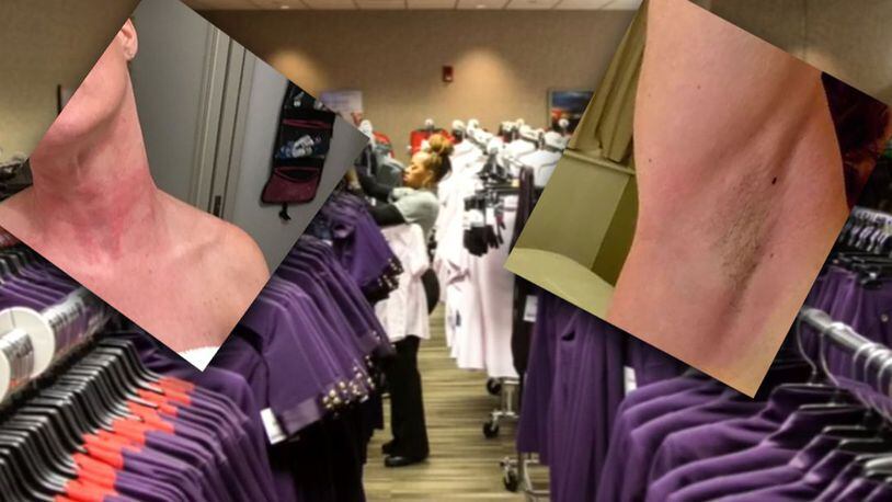 The company rolled out the new plum collection about a year ago. Since then, more than 2,400 Delta employees have joined a secret Facebook group to share their stories and pictures of how they say the uniform is affecting their health. (WSBTV.com)