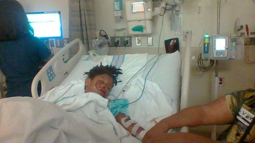 A 6-year-old boy is recovering at Dayton Children’s Hospital after being attacked by a dog in Springfield. (Photo: Springfield News-Sun)