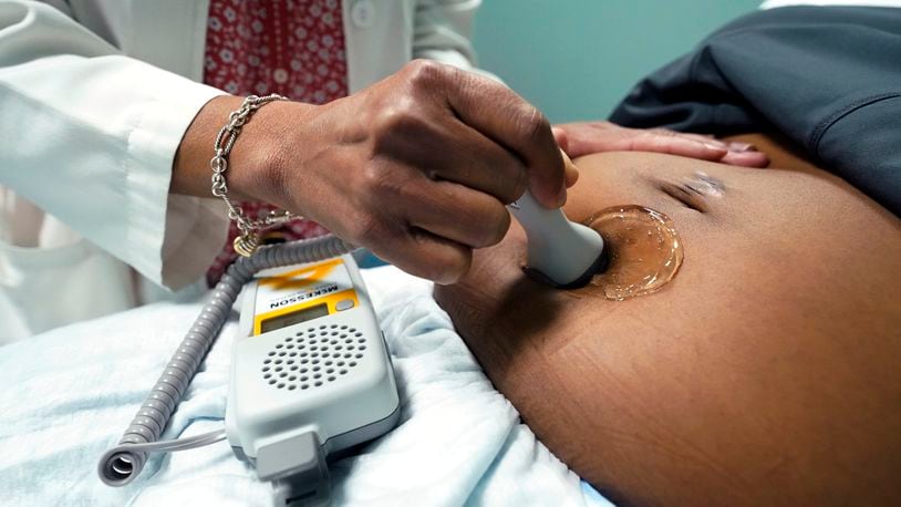 FILE - A doctor uses a hand-held Doppler probe on a pregnant woman to measure the heartbeat of the fetus on Dec. 17, 2021, in Jackson, Miss. Black women are at twice the risk of dying from pregnancy-related issues, according to the Centers for Disease Control. (AP Photo/Rogelio V. Solis, File)