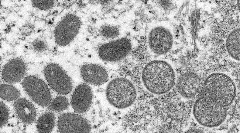 FILE - This 2003 electron microscope image made available by the Centers for Disease Control and Prevention shows mature, oval-shaped monkeypox virions, left, and spherical immature virions, right, obtained from a sample of human skin associated with the 2003 prairie dog outbreak. (Cynthia S. Goldsmith, Russell Regner/CDC via AP, File)