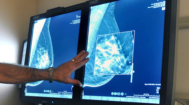 Breast cancer is the most common cancer in women, after non-melanoma skin cancer. (Torin Halsey/Times Record News via AP, File)
