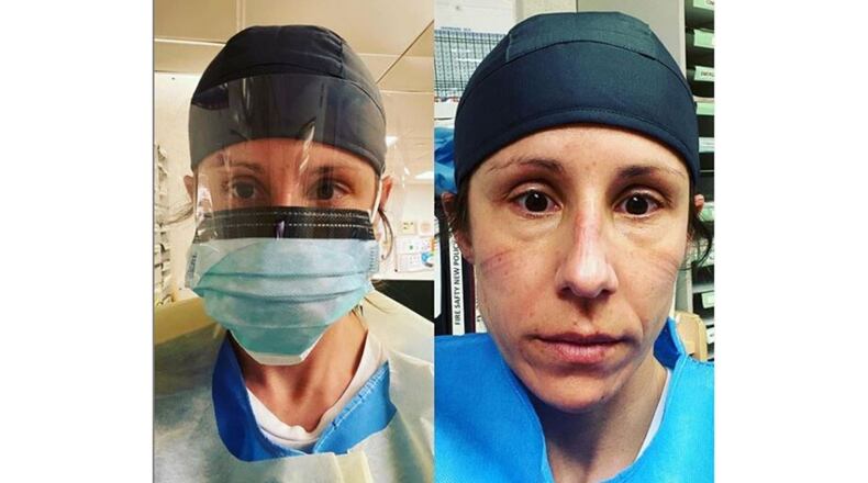 Clayton registered nurse Staci Hedke began a three week stint to help fight the coronavirus in New York. Hedke is pictured after her first 13 hour shift at Metropolitan Hospital.