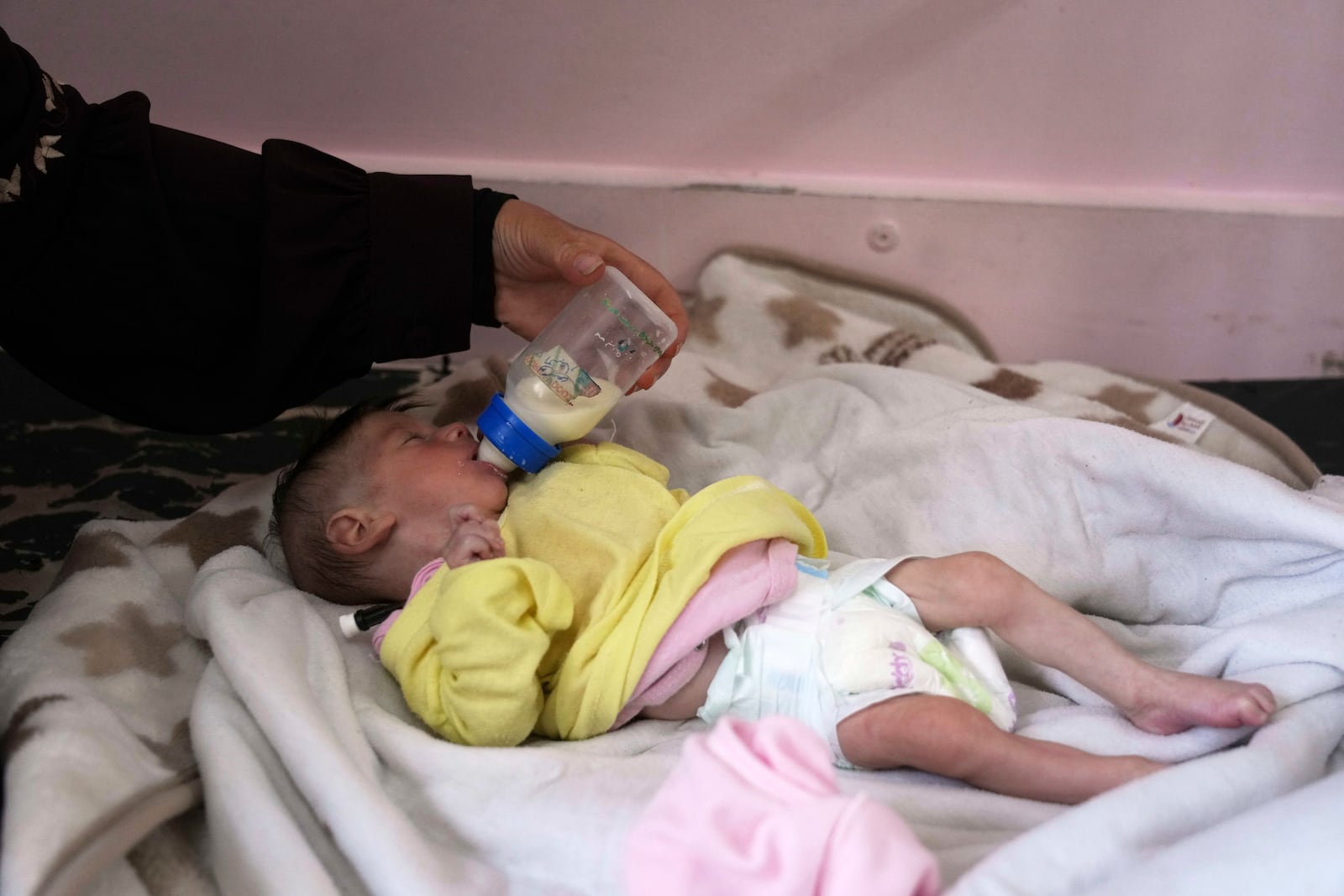Najia Al-Najjar feeds her five month old baby Yousef who suffers from malnutrition, at the malnutrition clinic in Nasser hospital, Khan Younis, Gaza, Wednesday, May 21, 2025. (AP Photo/Abdel Kareem Hana)
