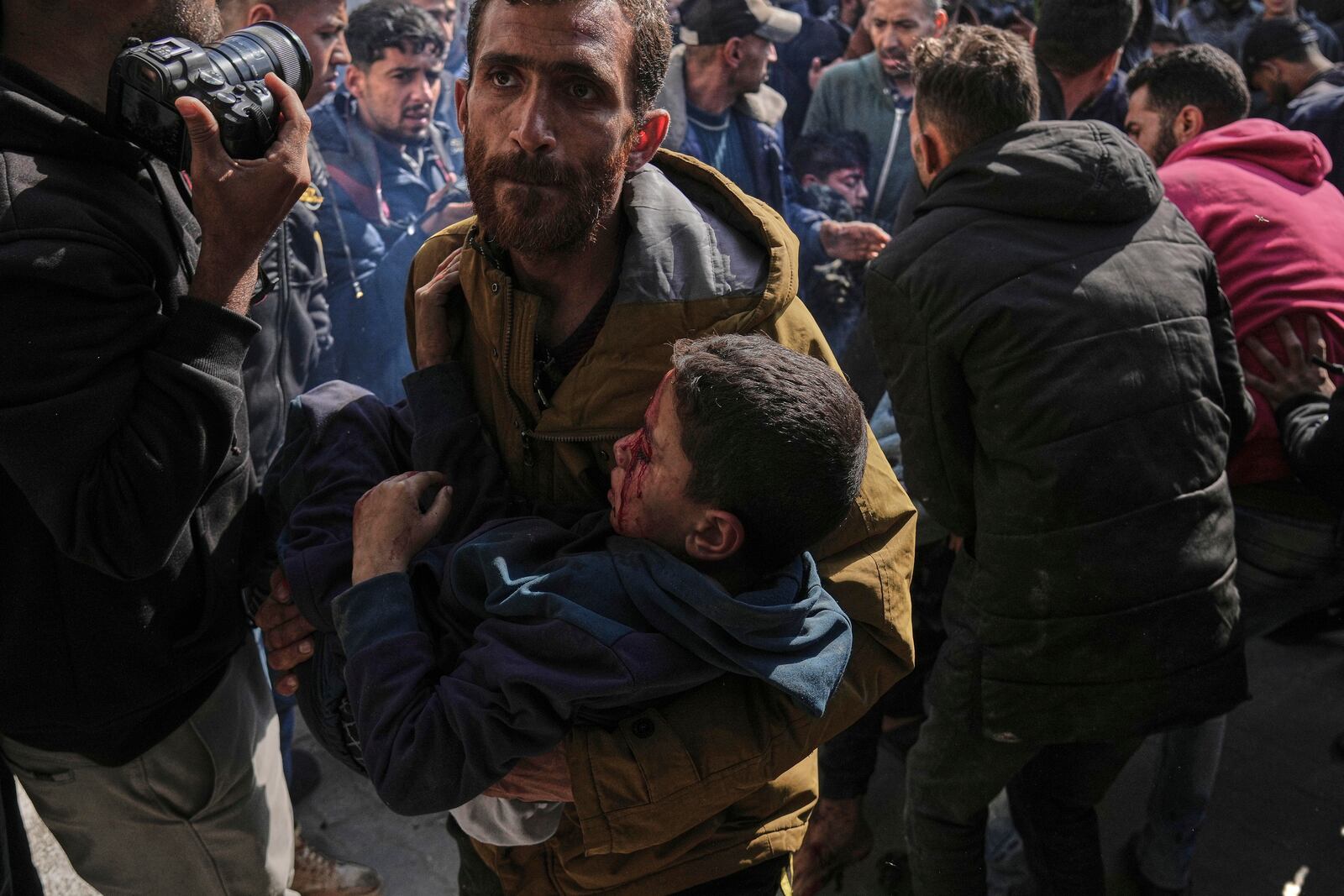 Palestinian children injured in an Israeli airstrike are brought to the Baptist Hospital in Gaza City, Saturday, April 12, 2025. (AP Photo/Jehad Alshrafi)