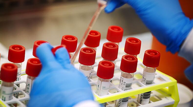 A technician prepares COVID-19 coronavirus patient samples for testing at a laboratory in New York’s Long Island. Wide scale testing is a critical part of tracking and containing infectious diseases. But the U.S. effort has been plagued by a series of missteps, including accuracy problems with the test kits the CDC sent to other labs and bureaucratic hurdles that slowed the entrance of large, private sector labs. (AP File Photo/John Minchillo)