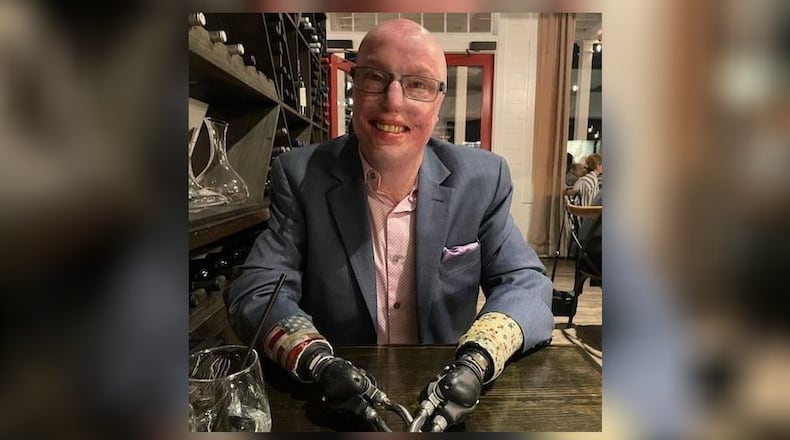 Michael Schlitz, an Army Ranger, was severely injured when the vehicle he was riding in was struck by an improvised explosive device (IED). His gunman and medic were killed instantly and his driver died shortly after the blast. He lost his hands and suffered burns over 85% of his body. CONTRIBUTED