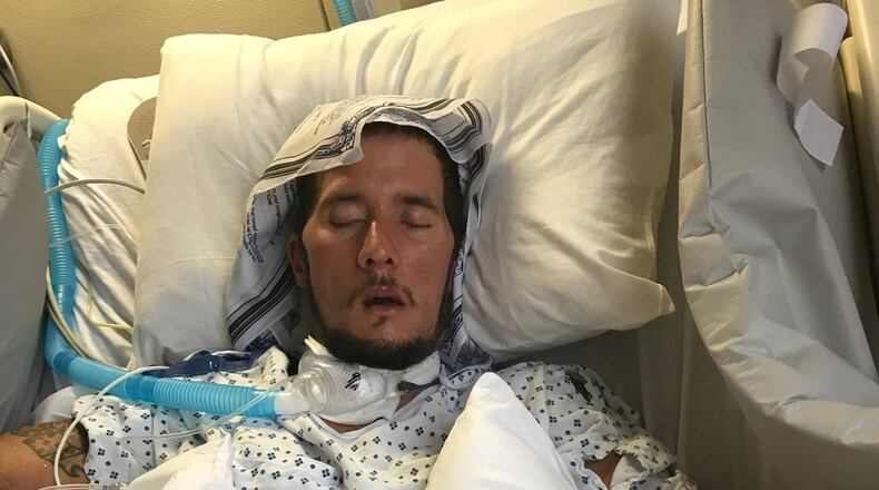 For the last month, Christopher Minor, 37, has been a patient at Sycamore Life Center in Miamisburg after he overdosed in his Middletown home. His family is hoping God can heal him.