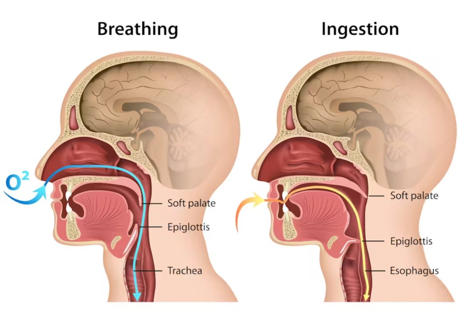 This diagram shows the digestive and nasal passages used in swallowing and breathing. Multiple muscles must work in tandem to successfully swallow. ISTOCK