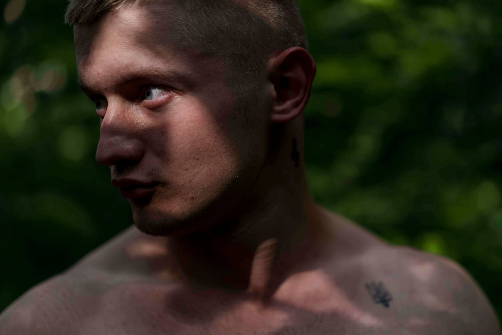 Ukrainian soldier Denys Zalizko, 21, stands outside of a rehabilitation center in Kyiv region, Ukraine, Wednesday, July 2, 2025. (AP Photo/Evgeniy Maloletka)