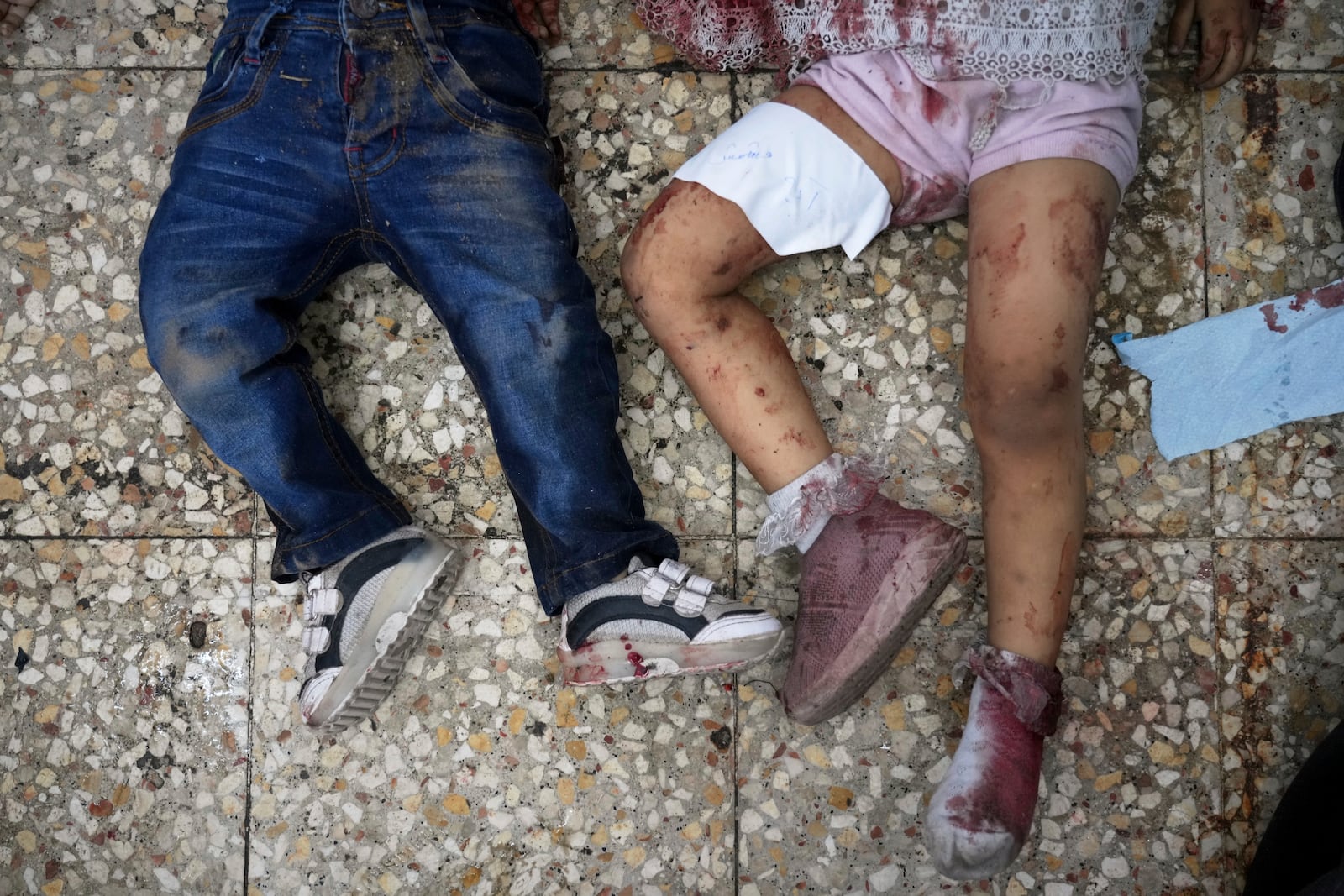 The bodies of two children lie on the hospital floor after an Israeli strike killed 10 people, including two women and five children, while they were waiting to receive nutritional supplements at a Project Hope-run medical clinic in Deir al-Balah, Gaza Strip, Thursday, July 10, 2025. (AP Photo/Abdel Kareem Hana)