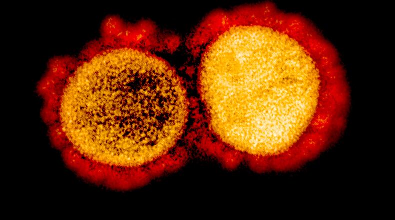 In an undated image provided by NIAID, a colored micrograph of the coronavirus, with its distinct protein spikes in red. In a laboratory in New York City, researchers coaxed a key piece of the coronavirus — its infamous outer “spike” — to mutate so that it became invisible to disease-fighting antibodies, underscoring the need for treatments and vaccines that attack the virus in different ways, so that if the pathogen manages to evade one approach, another will be waiting in the wings. (NIAID via The New York Times) -- NO SALES; FOR EDITORIAL USE ONLY WITH NYT STORY VIRUS MUTATIONS BY KATHERINE J. WU FOR JULY 28, 2020. ALL OTHER USE PROHIBITED. --
