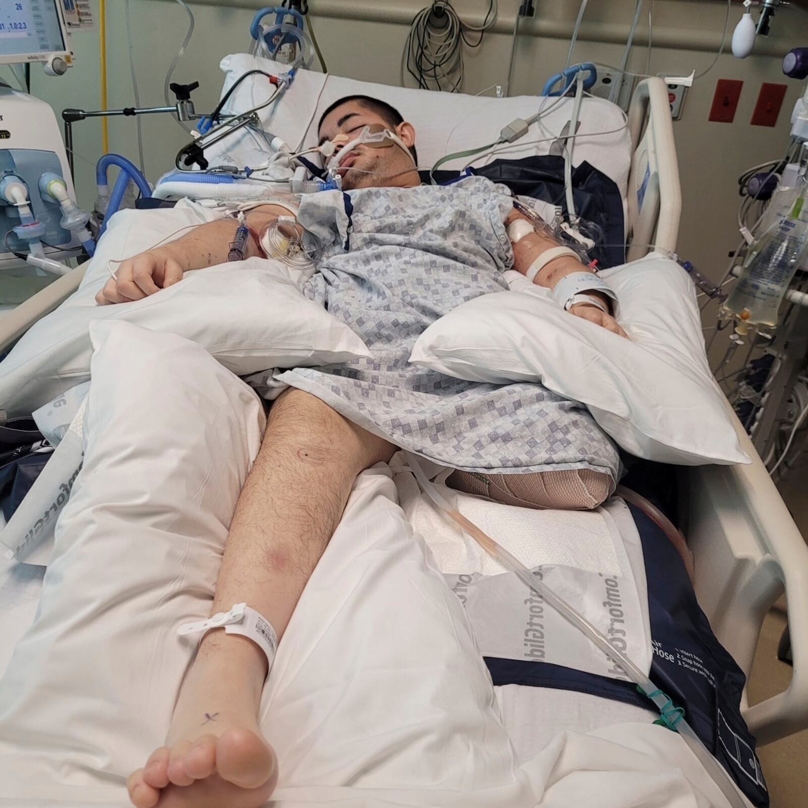 This photo provided by Ana L Vazquez, shows Victor Perez in a hospital bed in Pocatello, Idaho. (Ana L Vazquez via AP)