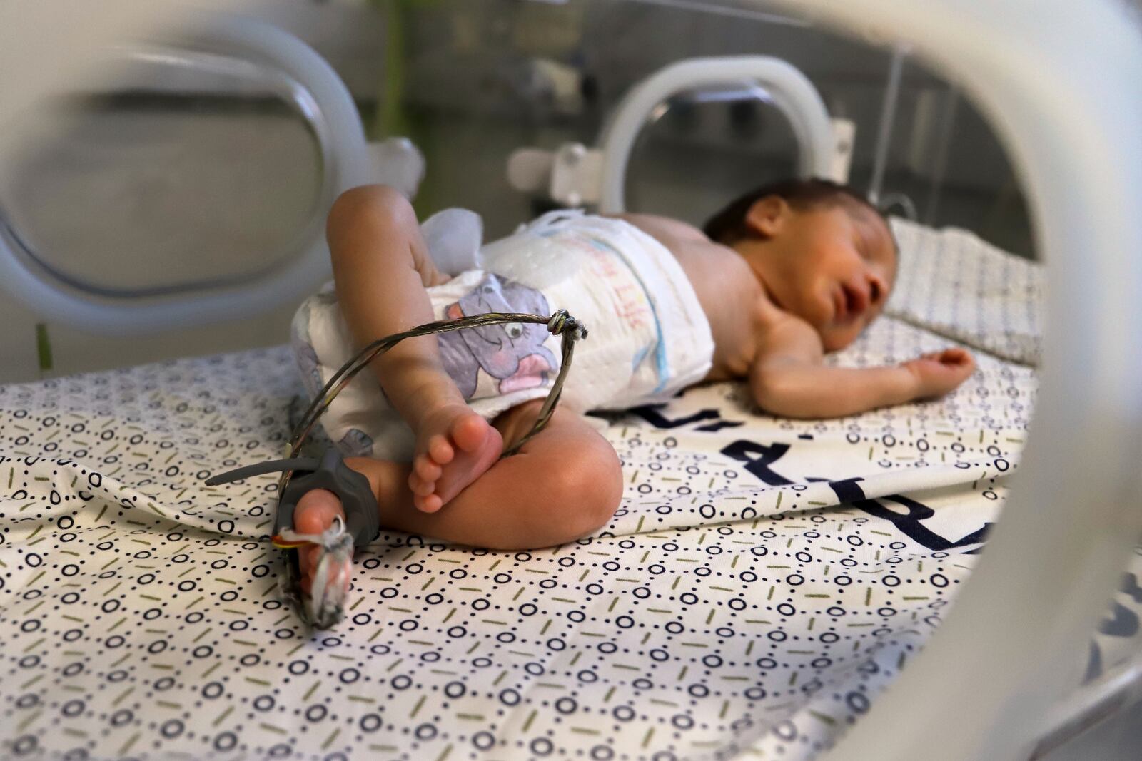 A prematurely born baby lies in an incubator at the neonatal intensive care unit of Nasser Hospital in Khan Younis, southern Gaza Strip, Thursday, June 19, 2025. (AP Photo/Mariam Dagga)