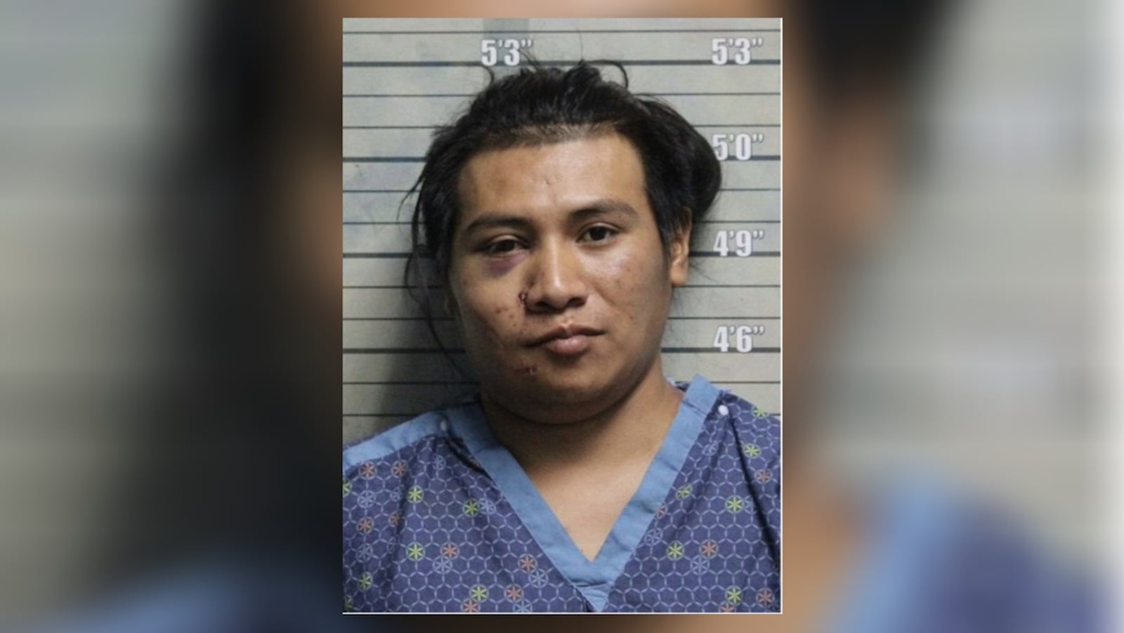 Yoan Perexz Ventula, 27, was arrested and charged with aggravated vehicular assault, obstruction of justice, OVI, driving without a driver's license and going left of center. BUTLER COUNTY SHERIFF'S OFFICE