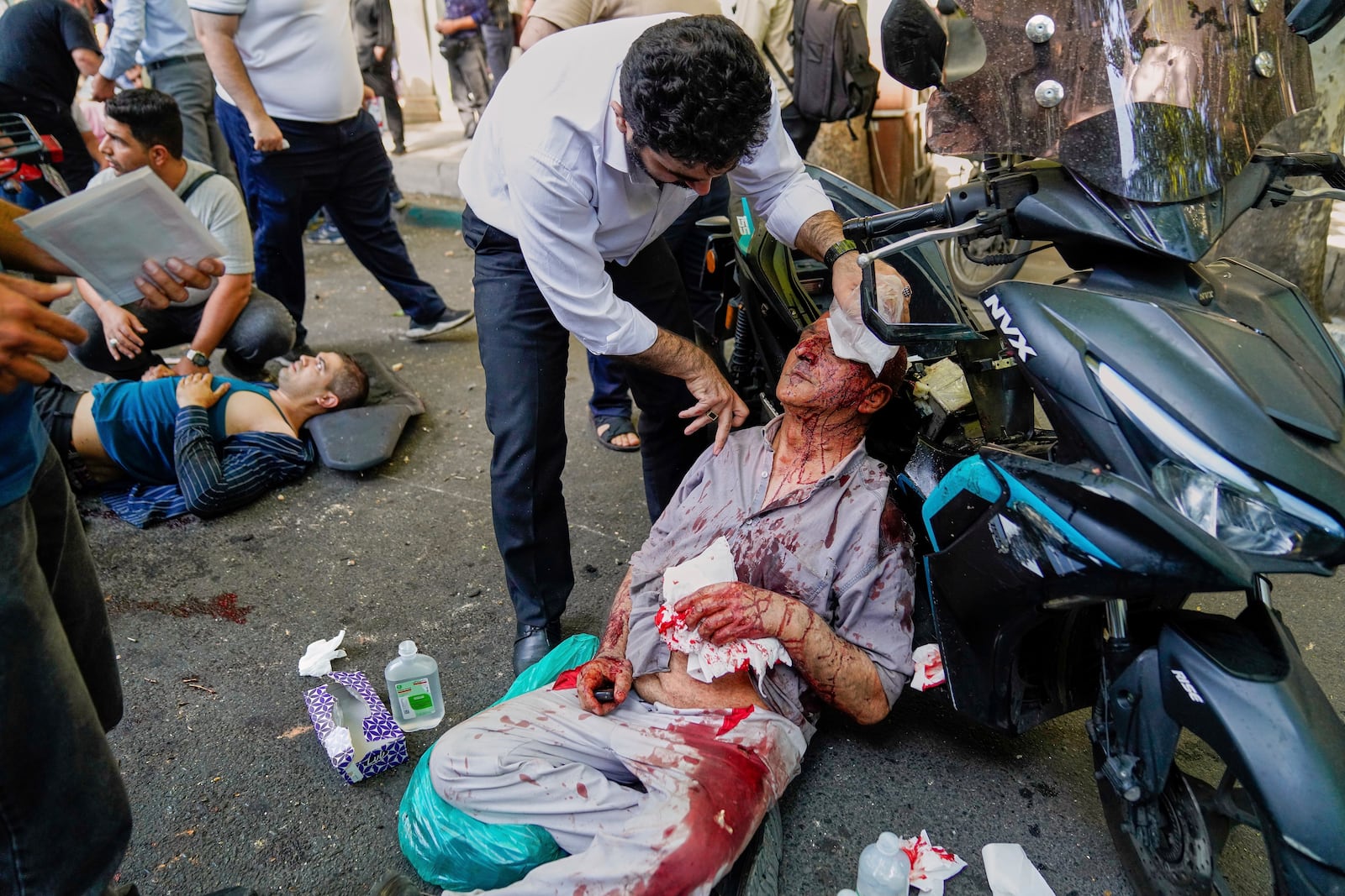 An injured man is assisted in the street after an explosion in downtown Tehran, amid Israel's three-day campaign of strikes against Iran, Sunday, June 15, 2025. (AP Photo/Morteza Zangene/ISNA)