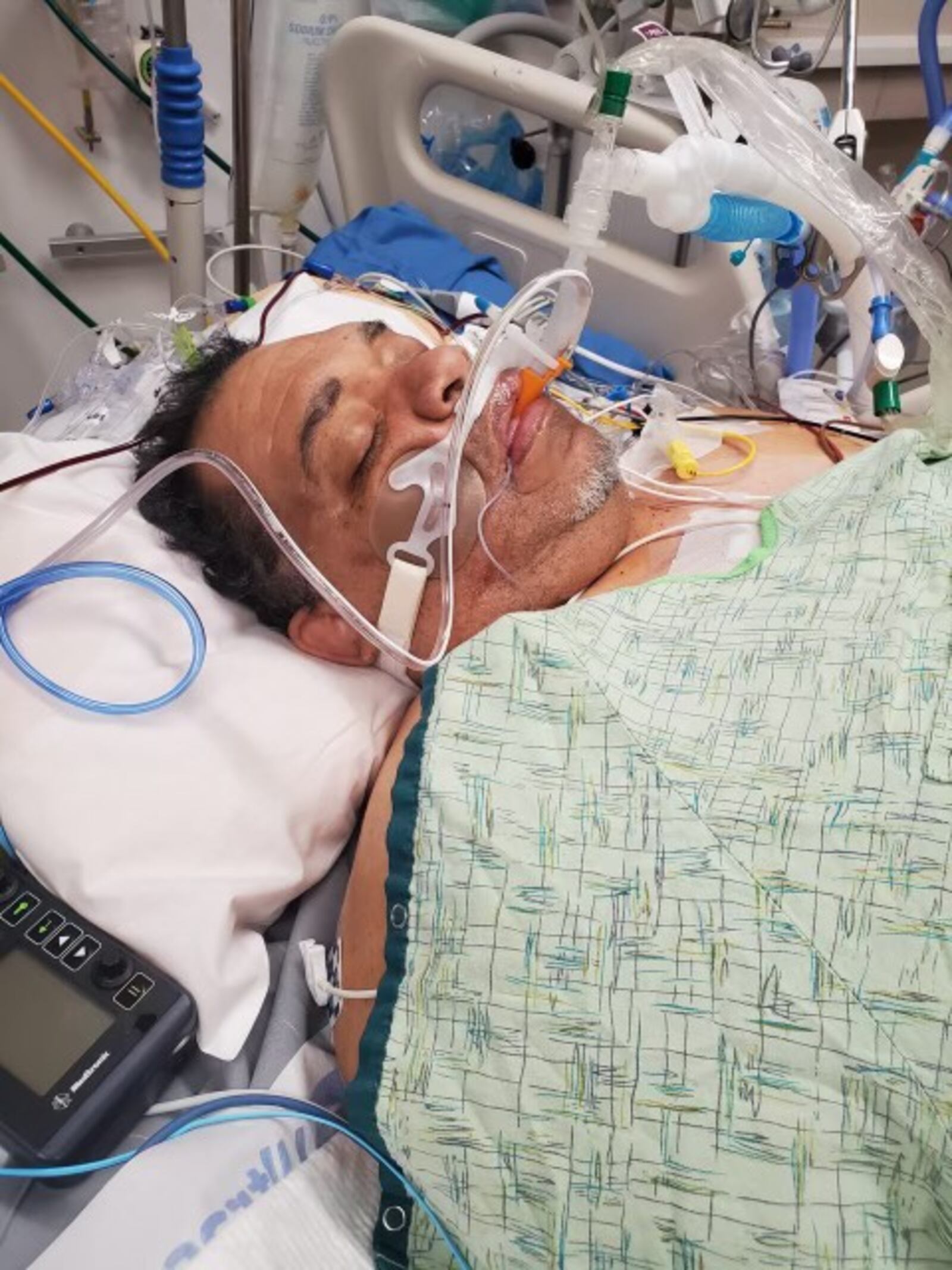 Al Milton, 56, of Middletown, spent time in the intensive care unit at UC Medical Center due to his heart disease. SUBMITTED PHOTO