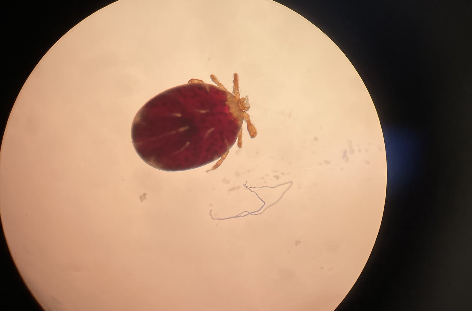 A new, invasive tick species - dangerous to humans, dogs, cats and cattle – may have been uncovered for the first time in Butler County thanks to an Oxford-based veterinarian. The Asian long-horned tick, shown here in a microscope photo at larva stage, first entered the eastern seaboard states of America in 2017 and has since spread westward. (Provided)