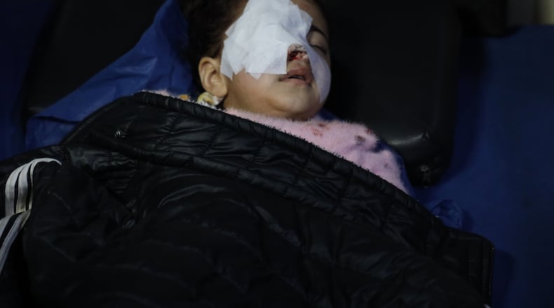 Syrian child Fatima al-Zahra Abu Sheikh, 4, lies in a hospital bed after being wounded when clashes broke out between Syrian government forces and Kurdish fighters in a contested area of the northern city of Aleppo, Syria, Tuesday, Jan. 6, 2026. (AP Photo/Omar Albam)