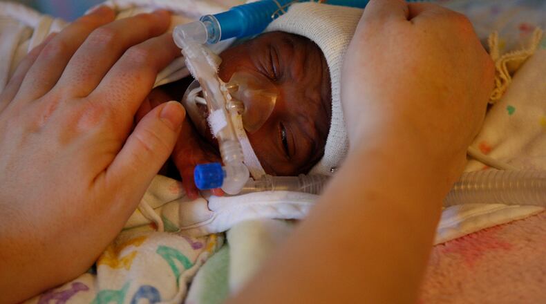 FILE — A 15-day-old baby who was born prematurely at an orphanage in Petionville, Haiti, on June 15, 2010. Premature births, after years of steady decline, rose sharply in the U.S. between 2014 and 2022, according to recently published data from the Centers for Disease Control and Prevention. (Ruth Fremson/The New York Times)