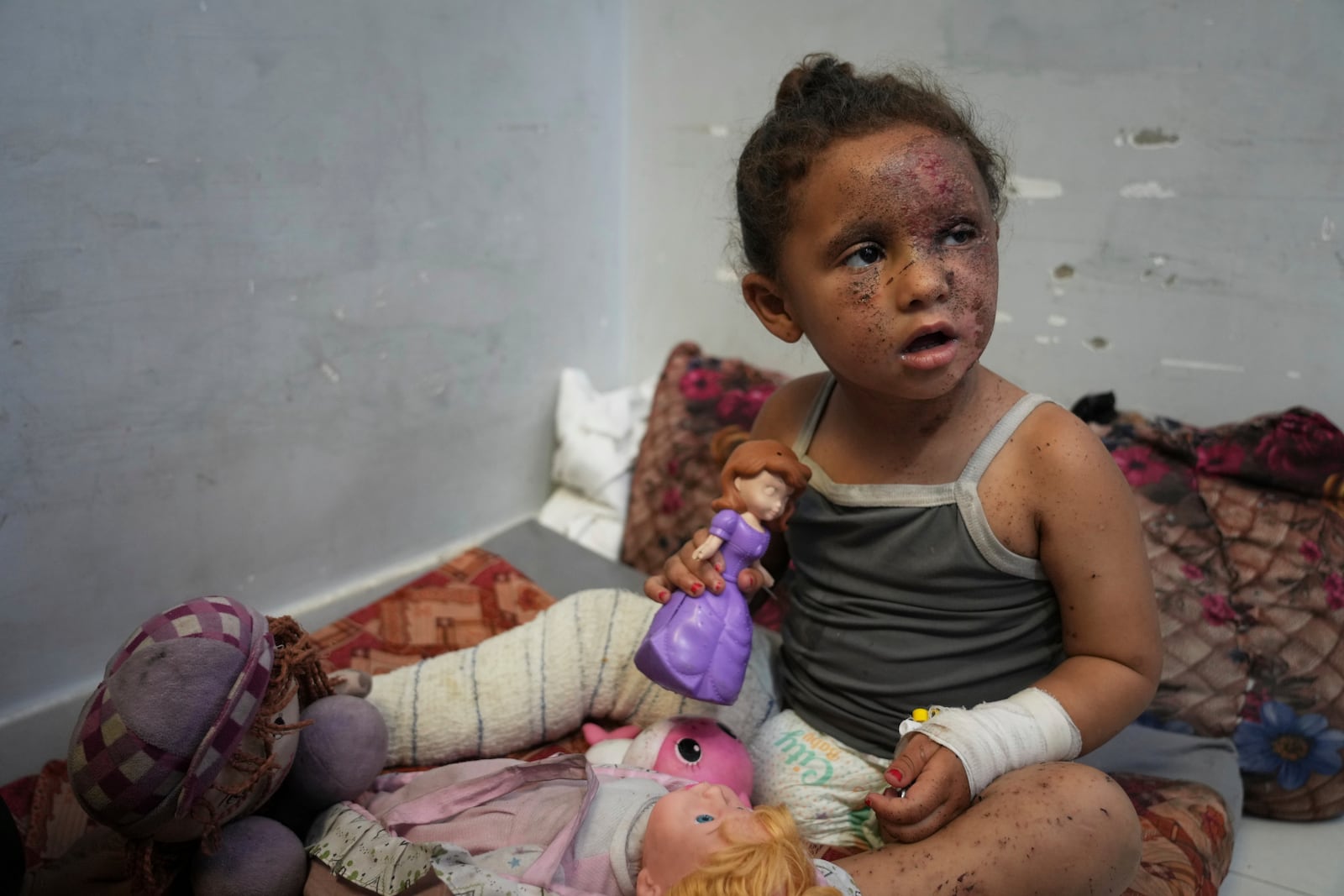 Layan Ibrahim Sahloul, 4, sits despondently among her dolls at Nasser hospital with second-degree burns on her face, foot, and stomach, caused a week earlier during an Israeli army strike on her home in Khan Younis that killed her pregnant mother and two siblings and buried her under the rubble, in Khan Younis, Gaza Strip, Sunday, May 4, 2025.(AP Photo/Abdel Kareem Hana)