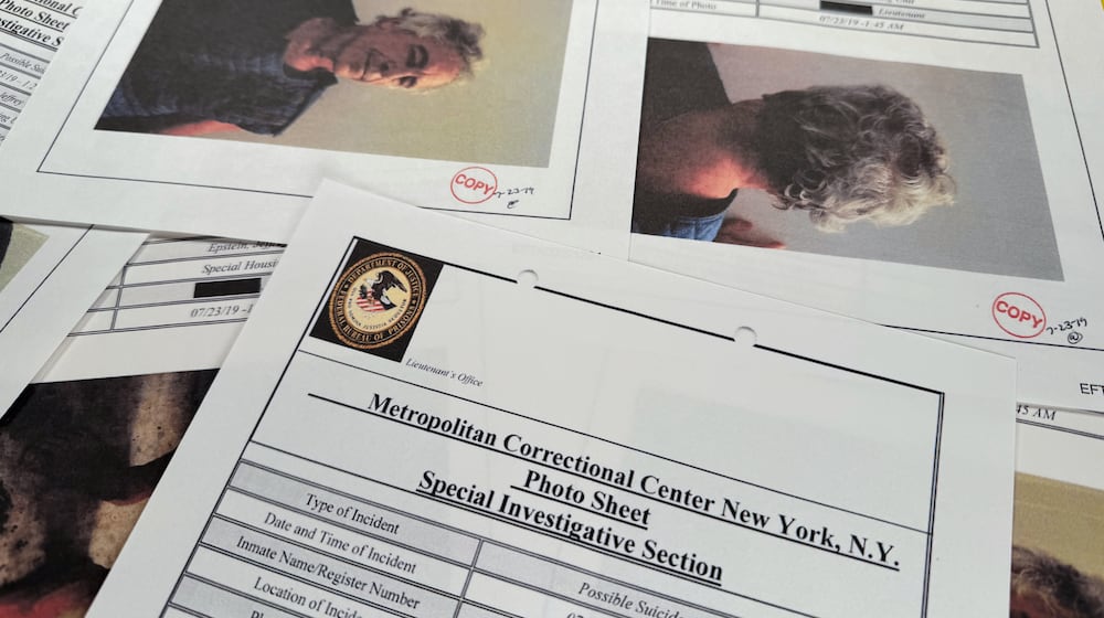 A document that was included in the U.S. Department of Justice release of the Jeffrey Epstein files, photographed Tuesday, Feb. 10, 2026, shows a Metropolitan Correctional Center report with photos of Epstein after a suicide attempt on July 23, 2019. (AP Photo/Jon Elswick)