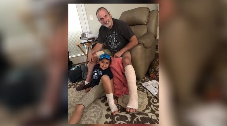 Barry Briggs, after treatment for flesh-eating bacteria and his son, Liam, who has an ankle injury. CONTRIBUTED