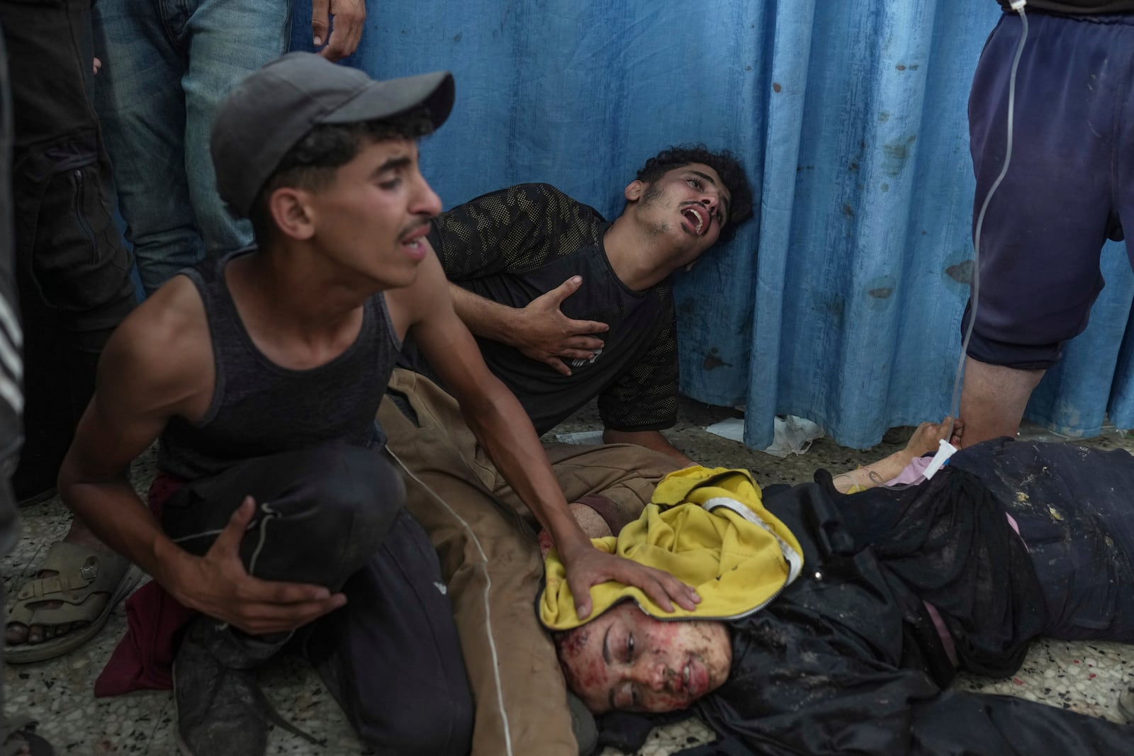 EDS NOTE: GRAPHIC CONTENT - Palestinians react beside their wounded sister, injured in an Israeli airstrike, as she brought to Shifa Hospital in Gaza City Saturday, July 12, 2025. (AP Photo/Jehad Alshrafi)