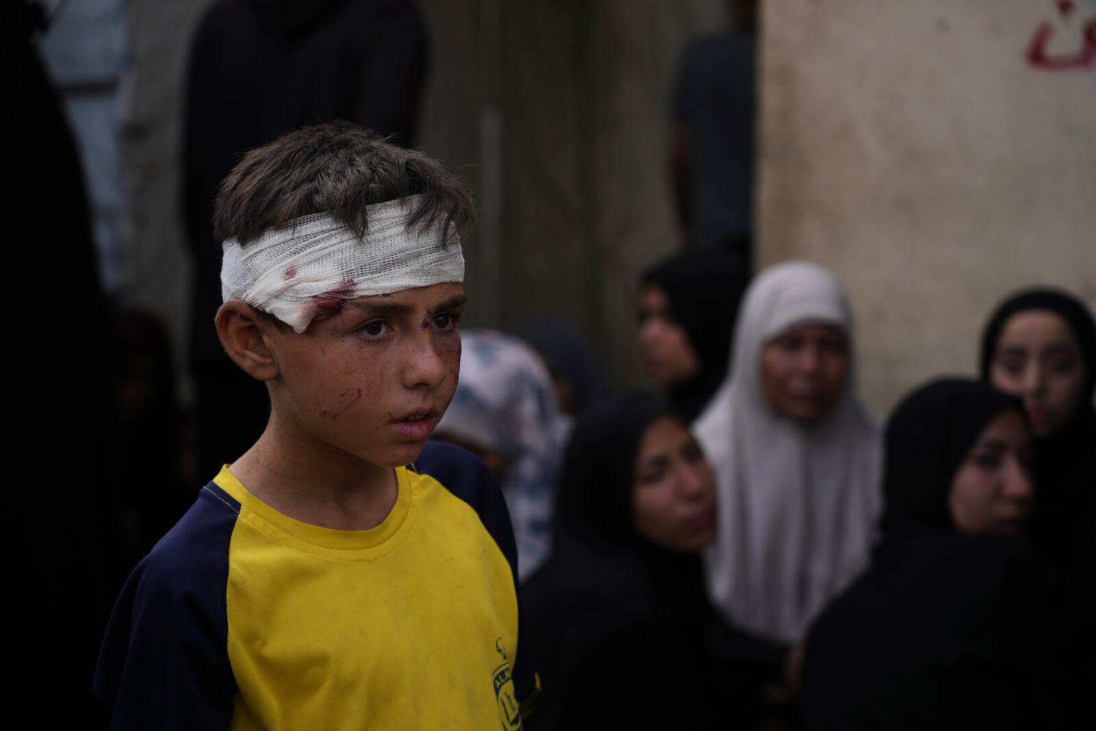 Ali Al-Aimawi attends the funeral of his relatives, who were killed in an Israeli bombardment of Al-Zawaideh, a strike in which he was also injured, at the morgue of Al-Aqsa Hospital in Deir al-Balah, Gaza Strip, on Tuesday, July 1, 2025. (AP Photo/Abdel Kareem Hana)