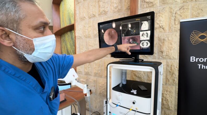 Mercy Health Fairfield Hospital acquired this summer the MONARCH surgical platform, a robotic-aided surgical tool that helps doctors find and biopsy potential cancer nodules or lesions. Pictured is Dr. Zolar Akhtar, a Mercy Fairfield pulmonologist, demonstrating the tool Mercy Fairfield acquired in June. MICHAEL D PITMAN/STAFF
